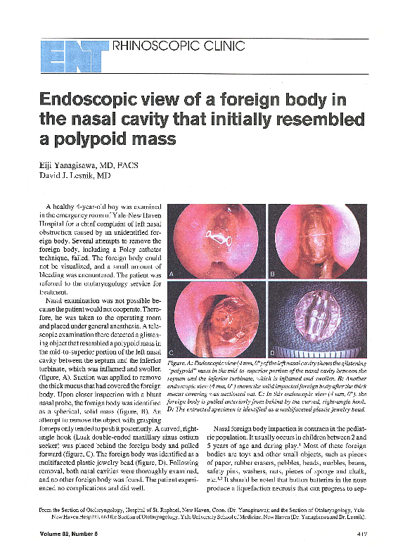 (PDF) Endoscopic view of a Foreign Body in the Nasal Cavity that ...