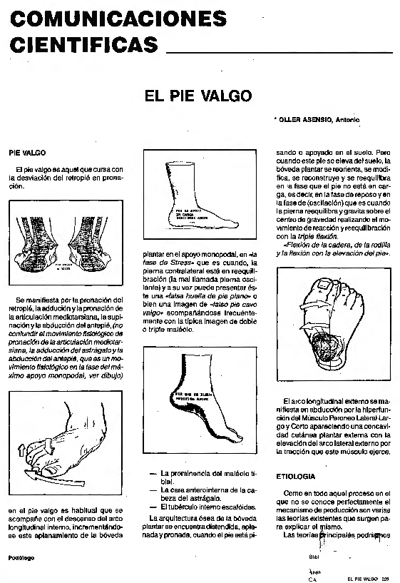 (PDF) El pie valgo