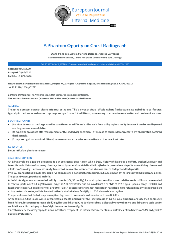 (PDF) A Phantom Opacity on Chest Radiograph