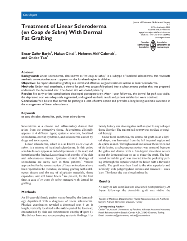 (PDF) Treatment of linear scleroderma “en coup de sabre” with AlloDerm ...