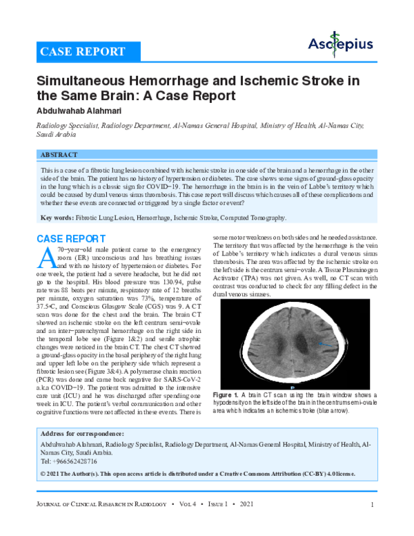 (PDF) Simultaneous Hemorrhage and Ischemic Stroke in the Same Brain: A ...