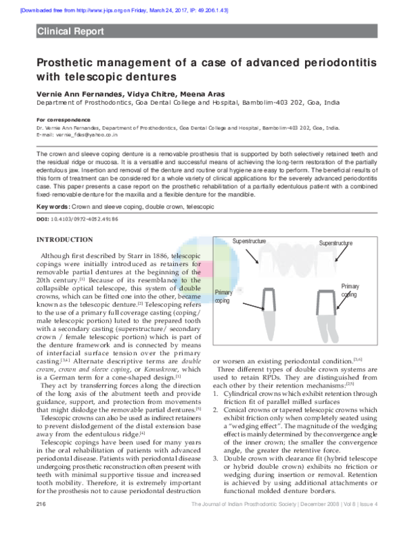 (PDF) Prosthetic management of a case of advanced periodontitis with ...