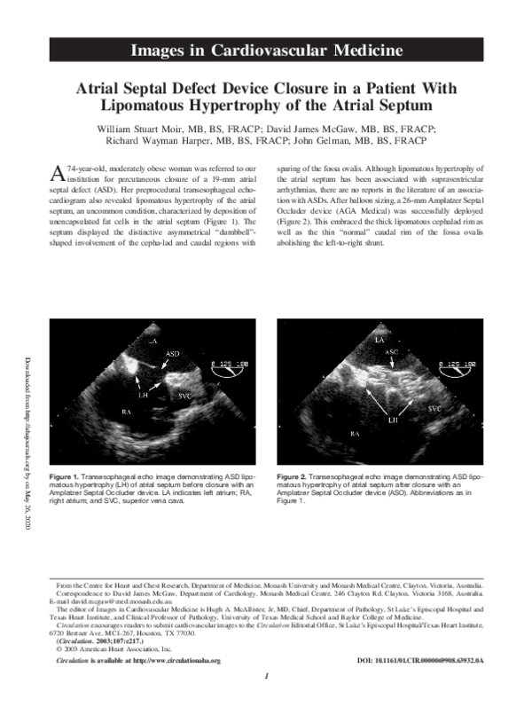 (PDF) Atrial Septal Defect Device Closure in a Patient With Lipomatous ...