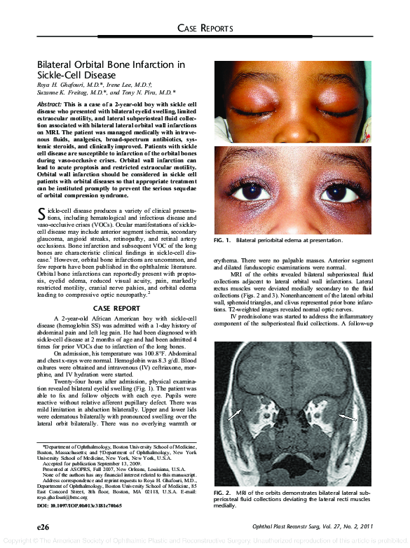 (PDF) Bilateral Orbital Bone Infarction in Sickle-Cell Disease