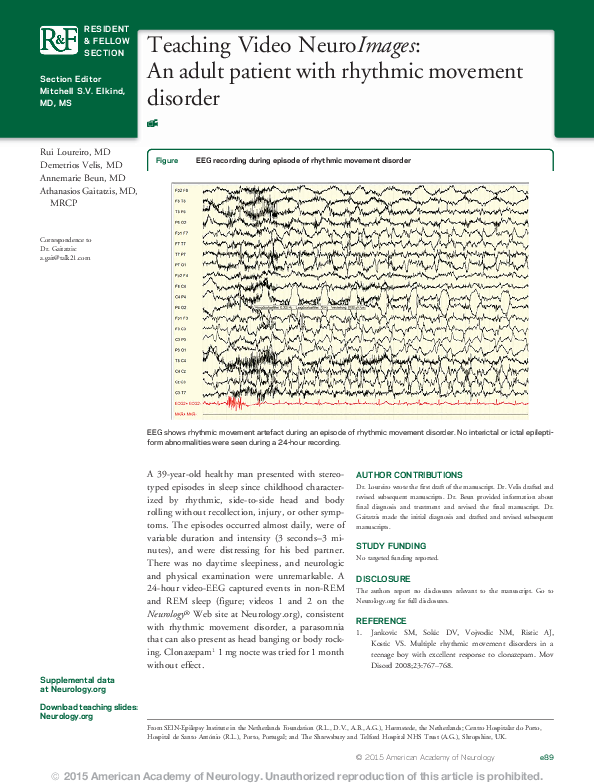 (PDF) Teaching Video NeuroImages: An adult patient with rhythmic ...
