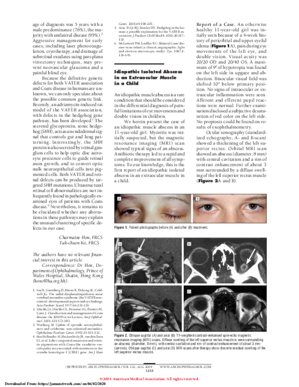 (PDF) Idiopathic Isolated Abscess in an Extraocular Muscle in a Child