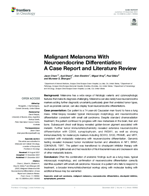 (PDF) Malignant Melanoma With Neuroendocrine Differentiation: A Case ...