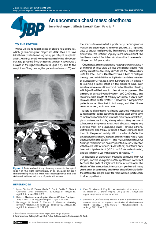 (PDF) An uncommon chest mass: oleothorax