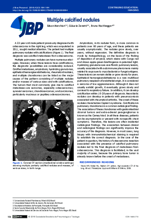 (PDF) Multiple calcified nodules