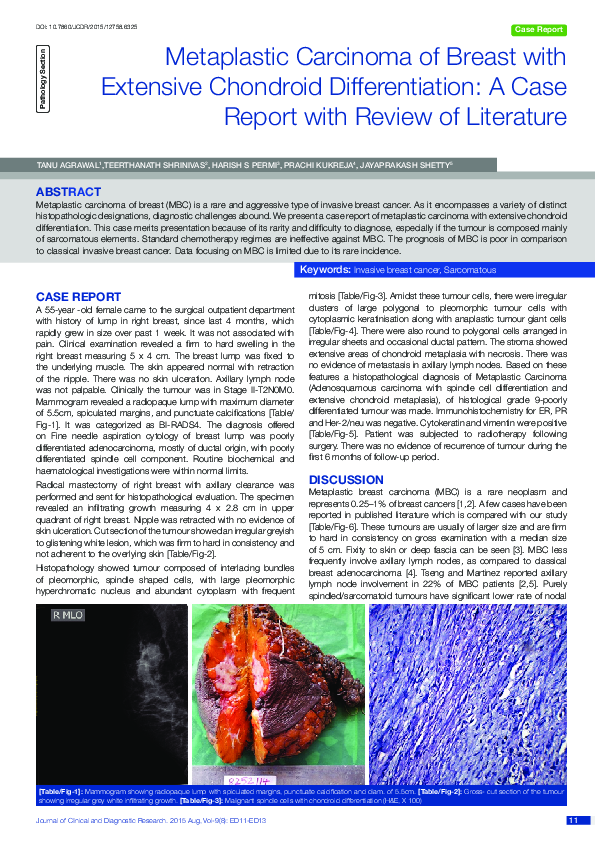 (PDF) Metaplastic Carcinoma of Breast with Extensive Chondroid ...