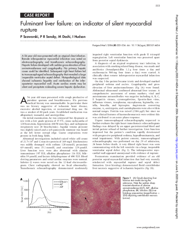 (PDF) Fulminant liver failure: an indicator of silent myocardial rupture