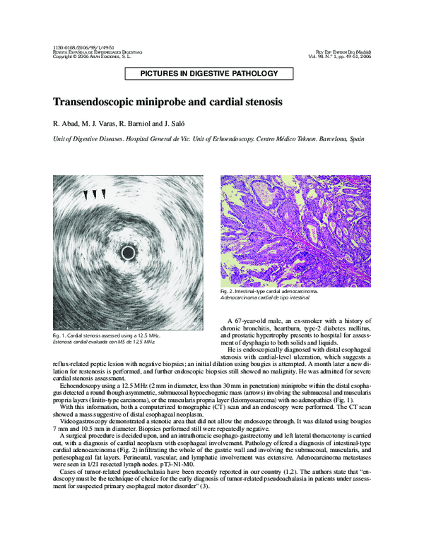 (PDF) Transendoscopic miniprobe and cardial stenosis
