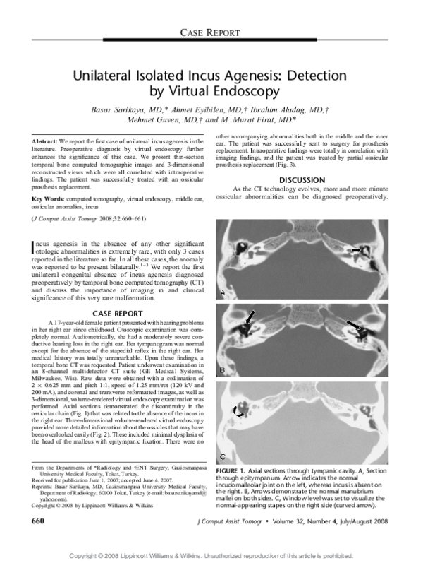 (PDF) Unilateral Isolated Incus Agenesis