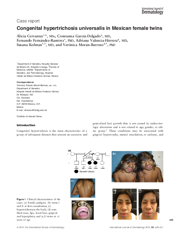 (PDF) Congenital hypertrichosis universalis in Mexican female twins