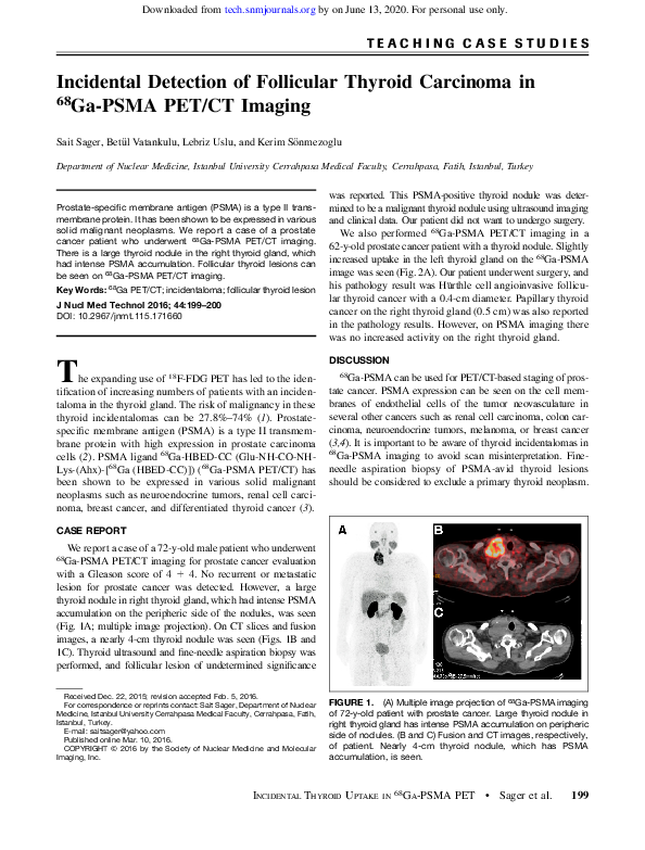 (PDF) Incidental Detection of Follicular Thyroid Carcinoma in 68Ga-PSMA ...
