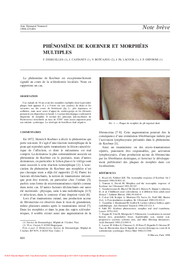 (PDF) Phénomène De Koebner et Morphées Multiples