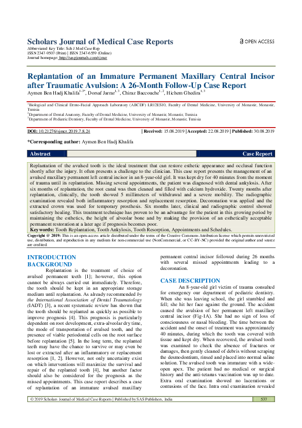 (PDF) Replantation of an Immature Permanent Maxillary Central Incisor ...