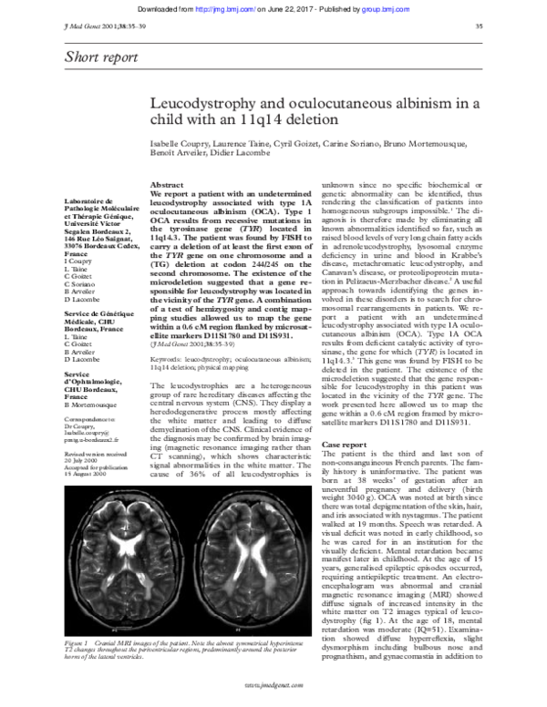 (PDF) Leucodystrophy and oculocutaneous albinism in a child with an ...