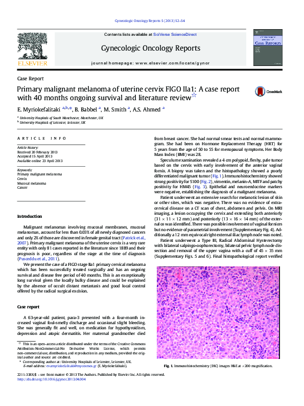 (PDF) Primary malignant melanoma of uterine cervix FIGO IIa1: A case ...
