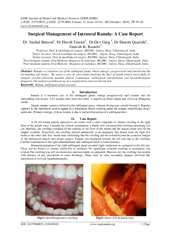 (PDF) Surgical Management of Intraoral Ranula : A Case Report Dr