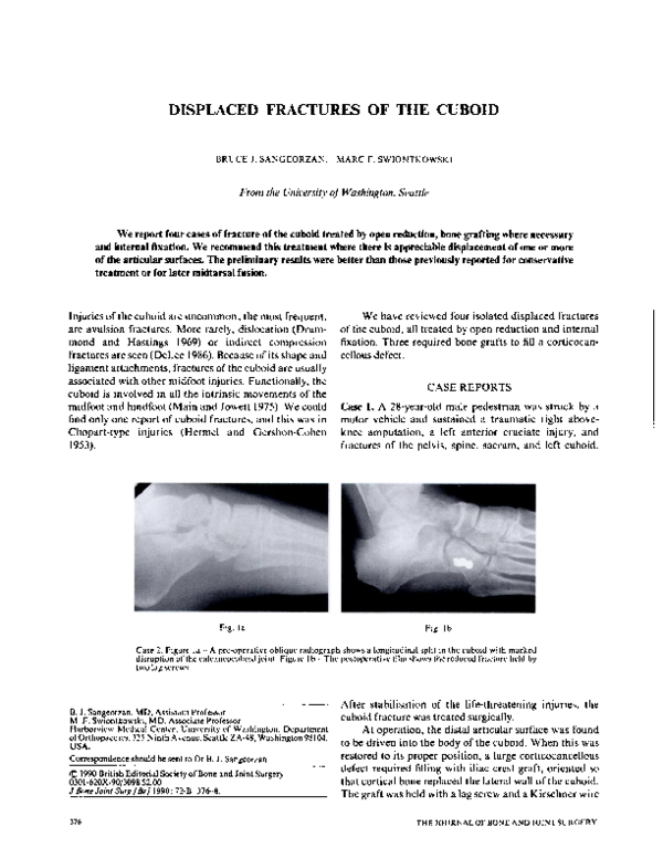 (PDF) Displaced fractures of the cuboid