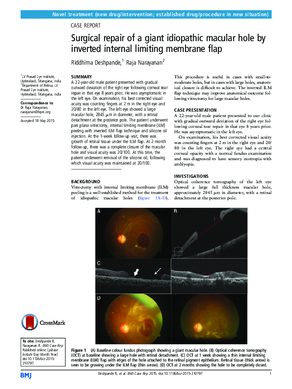 (PDF) Surgical repair of a giant idiopathic macular hole by inverted ...