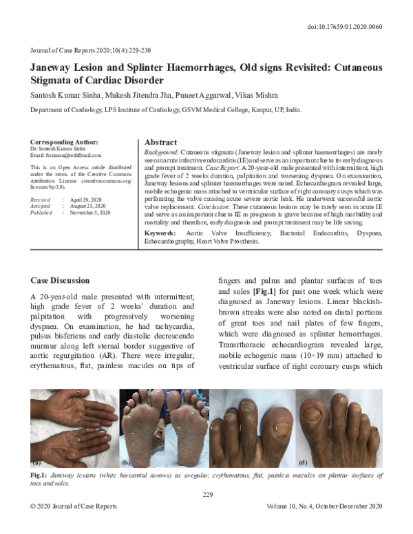 (PDF) Janeway Lesion and Splinter Haemorrhages, Old signs Revisited ...
