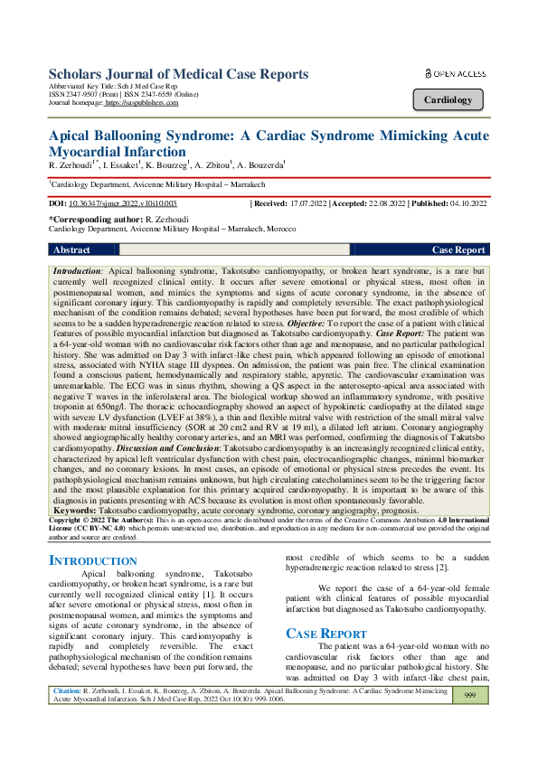 (PDF) Apical Ballooning Syndrome: A Cardiac Syndrome Mimicking Acute ...