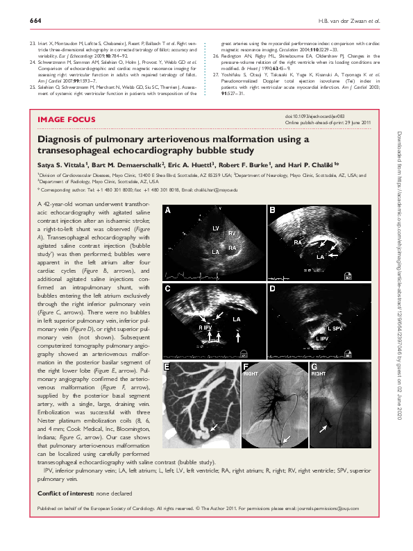 (PDF) Diagnosis of pulmonary arteriovenous malformation using a