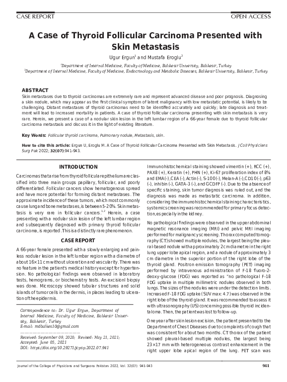 (PDF) A Case of Thyroid Follicular Carcinoma Presented with Skin Metastasis