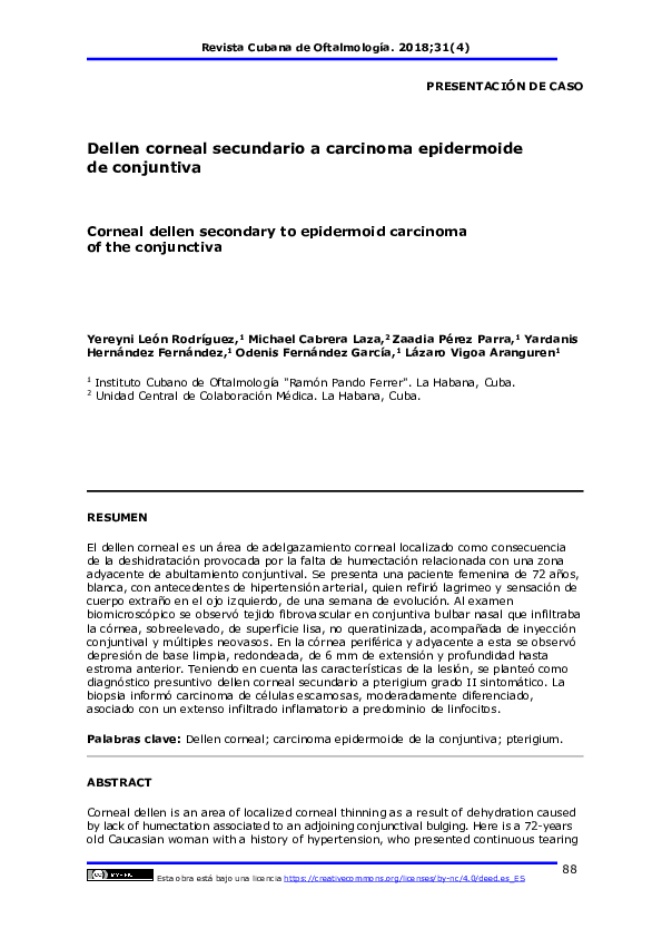 (PDF) Corneal dellen secondary to epidermoid carcinoma of the conjunctiva