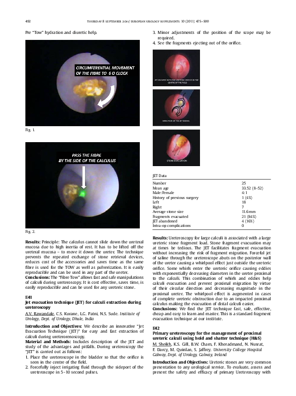 (PDF) E41 Jet evacuation technique (JET) for calculi extraction during ...