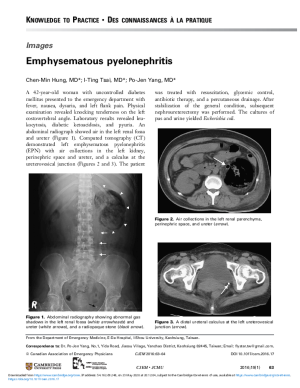 (PDF) Emphysematous pyelonephritis