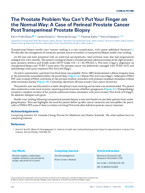 (PDF) Case of Perineal Prostate Cancer Post Biopsy