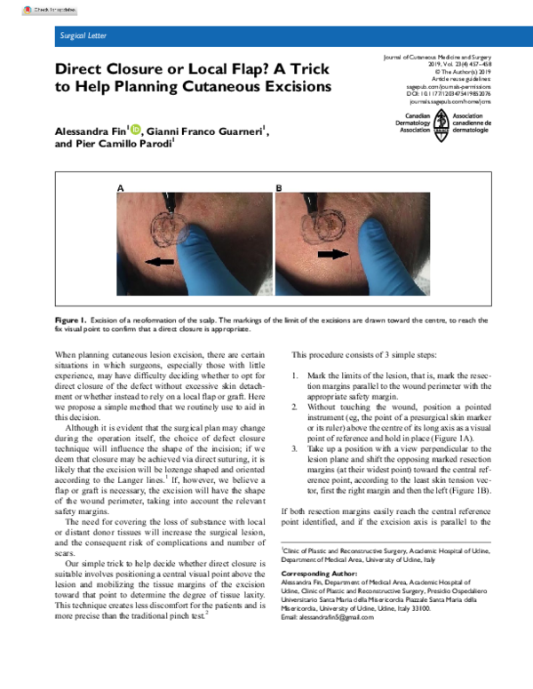 (PDF) Direct Closure or Local Flap? A Trick to Help Planning Cutaneous ...