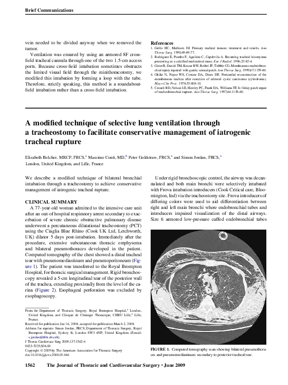 (PDF) A modified technique of selective lung ventilation through a ...