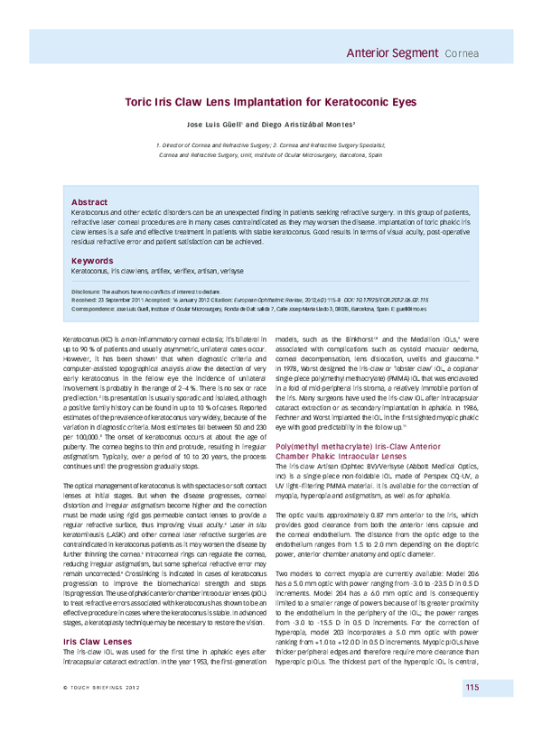 (PDF) Toric Iris Claw Lens Implantation for Keratoconic Eyes
