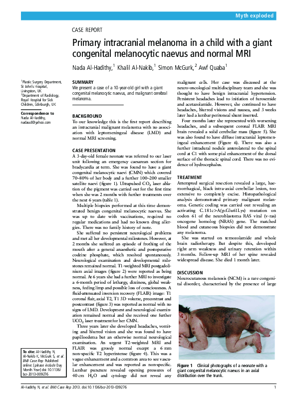 (PDF) Primary intracranial melanoma in a child with a giant congenital ...