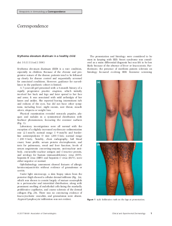 (PDF) Erythema elevatum diutinum in a healthy child