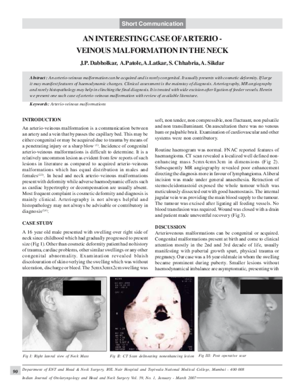 (PDF) An interesting case of arterio-veinous malformation in the neck
