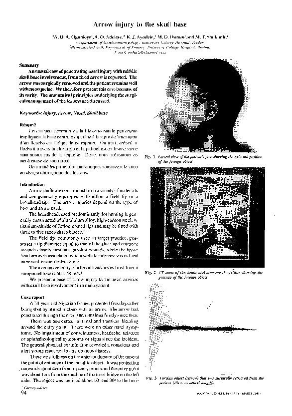 (PDF) Arrow injury to the skull base
