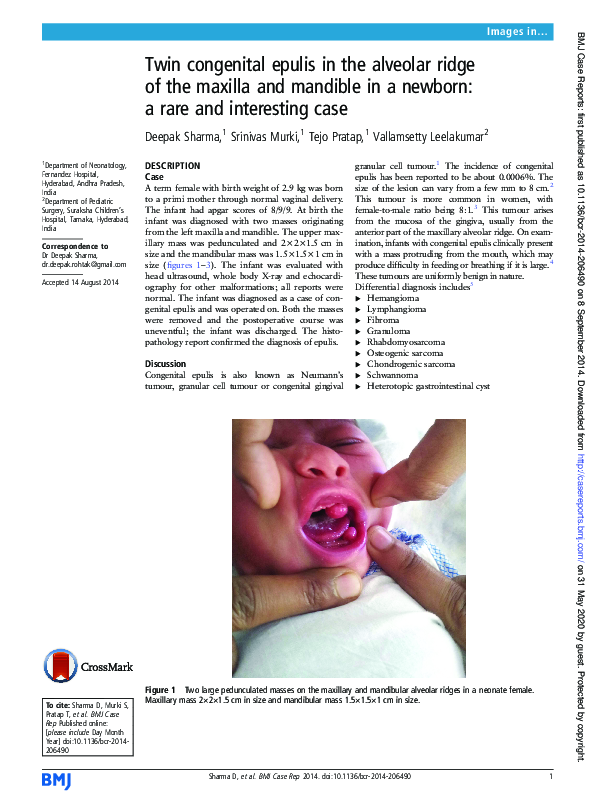 (PDF) Twin congenital epulis in the alveolar ridge of the maxilla and ...