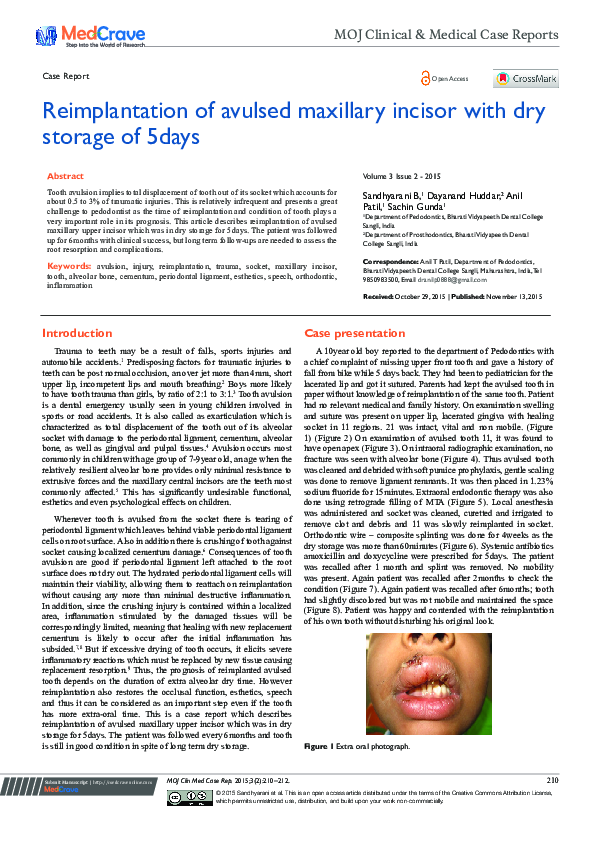 (PDF) Reimplantation of Avulsed Maxillary Incisor with Dry Storage of 5 ...