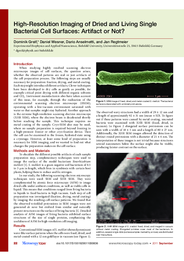 (PDF) High-Resolution Imaging of Dried and Living Single Bacterial Cell ...