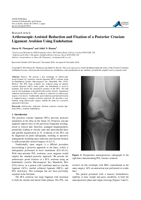 (PDF) Arthroscopic-Assisted Reduction and Fixation of a Posterior ...