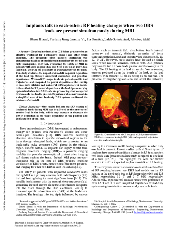 (PDF) Implants talk to each-other: RF heating changes when two DBS ...