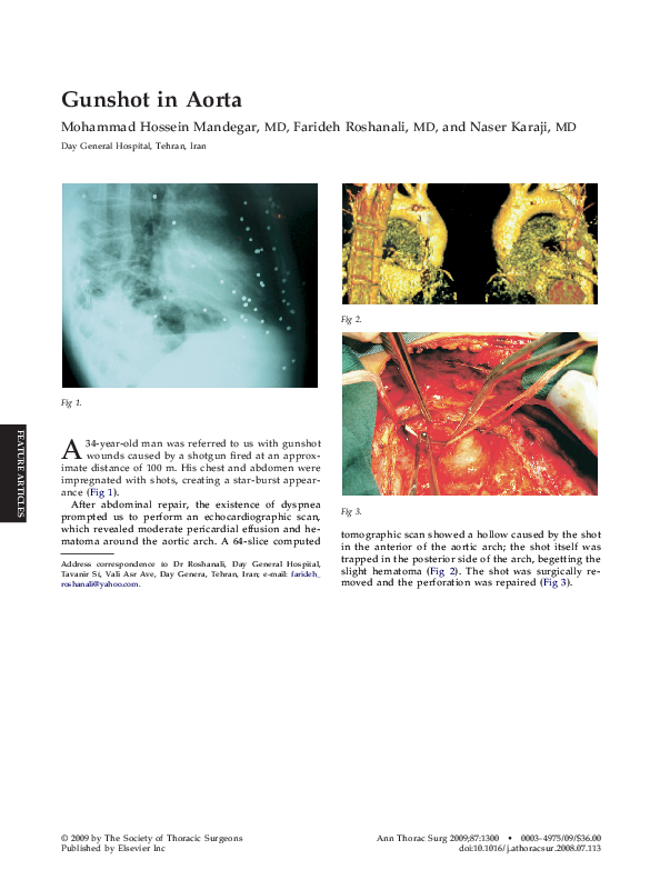 (PDF) Gunshot in Aorta