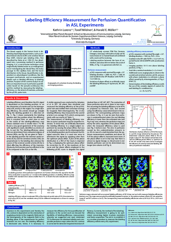 (PDF) Labeling efficiency measurements for perfusion quantification in ...