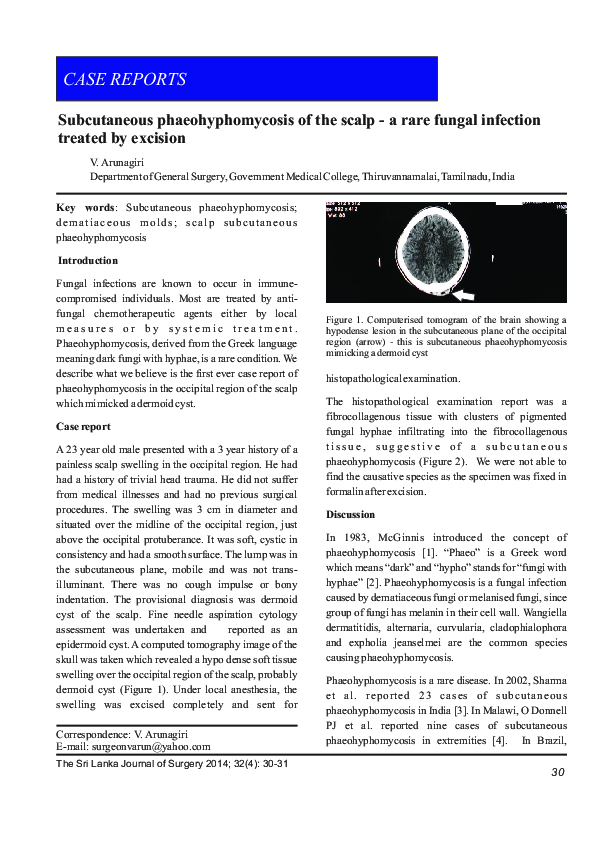 (PDF) Subcutaneous phaeohyphomycosis of the scalp - a rare fungal ...