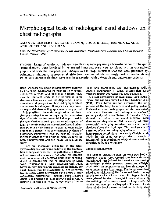 (PDF) Morphological basis of radiological band shadows on chest radiographs